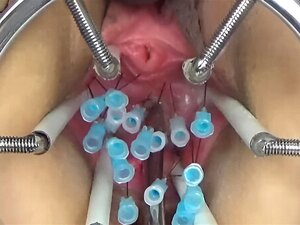 Extreme Cervix Insertion Pussy Hentai - Don't Miss Cervix Porn Videos at xecce.com